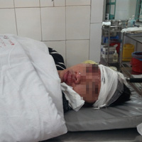 Pháp luật - Đi chơi valentine với bạn gái, bị đánh nhập viện