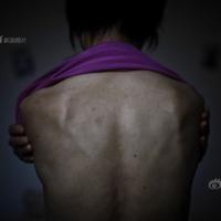 Tin tức trong ngày - Ám ảnh làng ung thư tử thần ở Trung Quốc