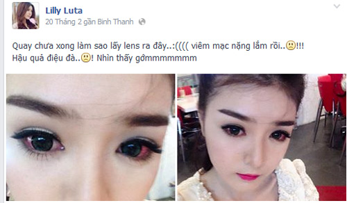 Sau khi bị viêm mắt nặng, Lily Luta nói tạm biệt kính áp 