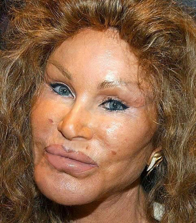Người đàn bà có tên Jocelyn Wildenstein đã chi ra rất nhiều tiền để đổi lại khuôn mặt biến dạng khủng khiếp
