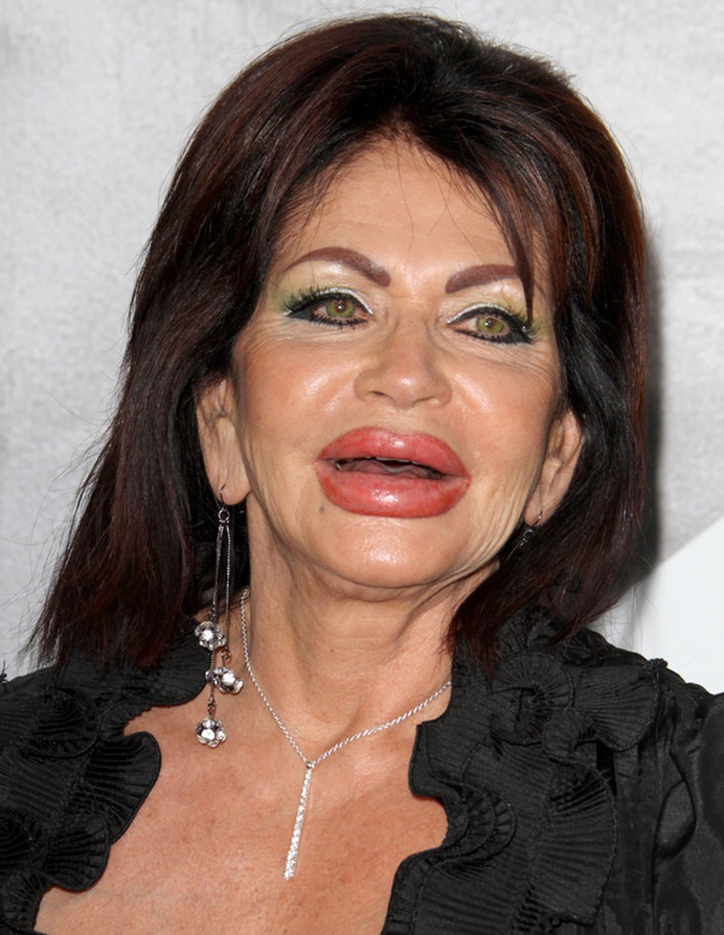 Nữ diễn viên Jackie Stallone đã tự tay phá hủy nhan sắc khi thực hiện hàng loạt cuộc phẫu thuật. Ngôi sao điện ảnh từng thừa nhận rằng mình bị nghiện dao kéo
