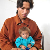 Sức khỏe đời sống - Bé 5 tuổi trông như trẻ sơ sinh