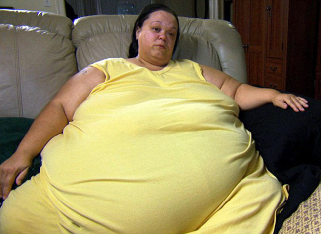Cuộc sống béo phì khiến cô bị giới hạn mọi thứ trong cuộc sống
