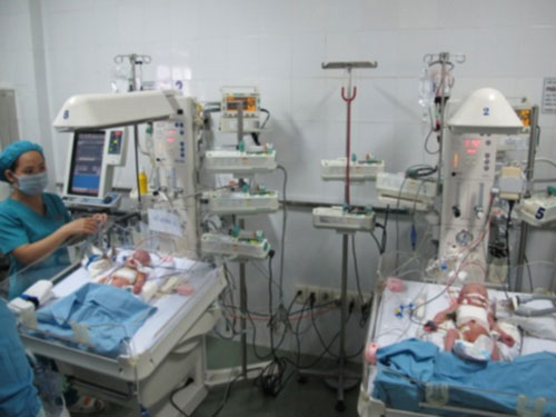 Hai bé gái dính liền: Có thể bị nhiễm trùng - 1