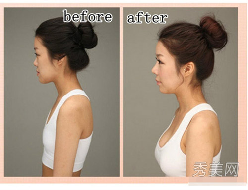 Thán phục công nghệ "cóc hóa tiên" ở Hàn - 1