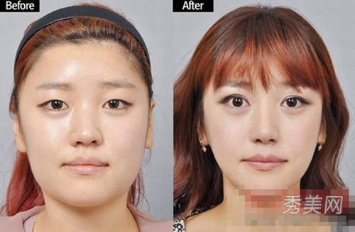 Thán phục công nghệ "cóc hóa tiên" ở Hàn - 10