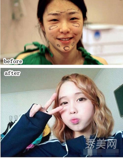 Thán phục công nghệ "cóc hóa tiên" ở Hàn - 11