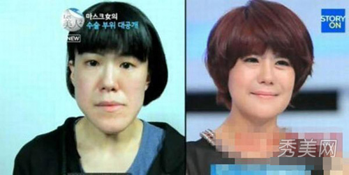 Thán phục công nghệ "cóc hóa tiên" ở Hàn - 13