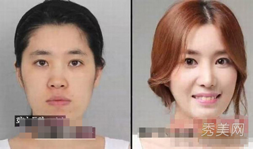 Thán phục công nghệ "cóc hóa tiên" ở Hàn - 14