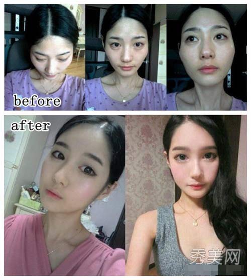 Thán phục công nghệ "cóc hóa tiên" ở Hàn - 15