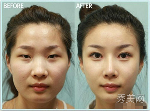 Thán phục công nghệ "cóc hóa tiên" ở Hàn - 2