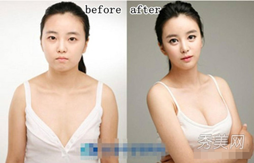 Thán phục công nghệ "cóc hóa tiên" ở Hàn - 3