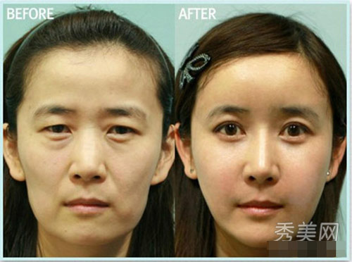 Thán phục công nghệ "cóc hóa tiên" ở Hàn - 4