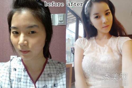 Thán phục công nghệ "cóc hóa tiên" ở Hàn - 6