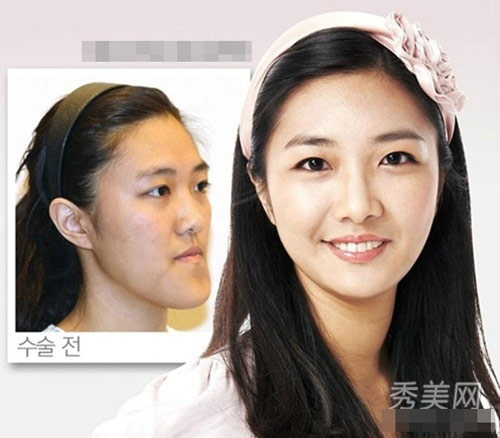 Thán phục công nghệ "cóc hóa tiên" ở Hàn - 8