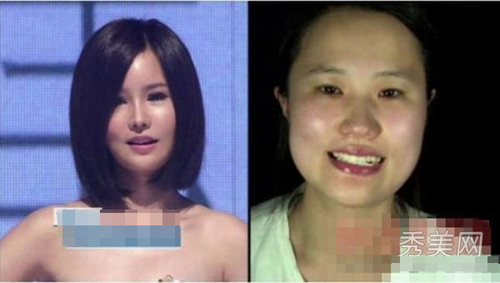 Thán phục công nghệ "cóc hóa tiên" ở Hàn - 9