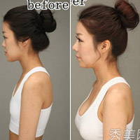 Thẩm mỹ viện - Thán phục công nghệ "cóc hóa tiên" ở Hàn