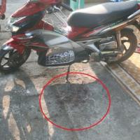 Pháp luật - Tâm sự của người bị bạn trai bắn vào mặt