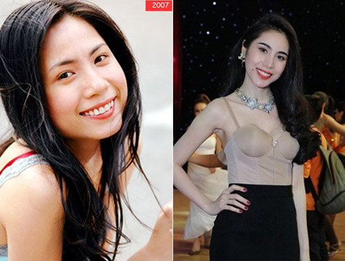 Mỹ nhân Việt thay đổi khi sửa mũi - 8