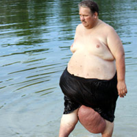 Phi thường - kỳ quặc - Cuộc sống cực hình của chàng hơn 300kg