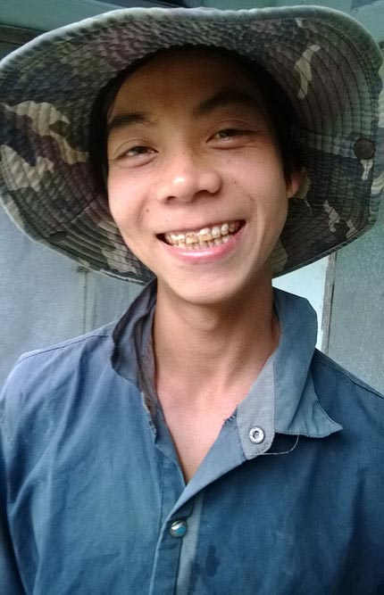 Chuyện cười ra nước mắt ở "làng không răng" - 2