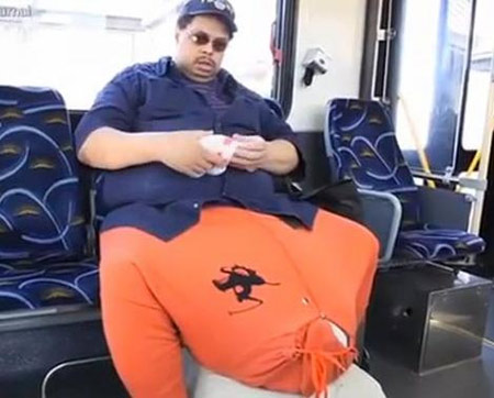 Người có "của quý" nặng gần 60 kg qua đời - 1