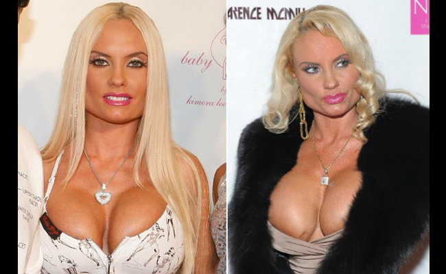 Coco Austin cũng là một nạn nhân của dao kéo
