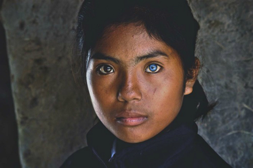 Cô gái có đôi mắt hai màu kỳ lạ ở Ninh Thuận - 1