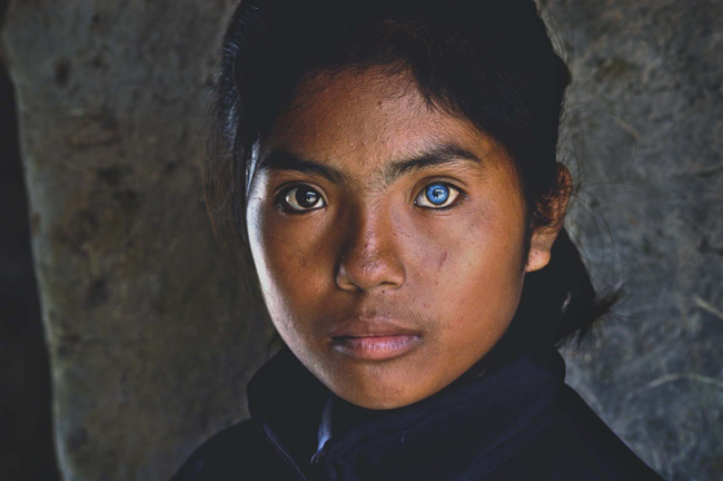 Đôi mắt hai màu đen và xanh của em Thạch Thị Sa Pa, 14 tuổi , người dân tộc Chăm ở xã Phú Quý, Ninh Phước, Ninh Thuận.