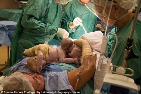 Mẹ tự tay đưa 2 con sinh đôi ra đời - 1