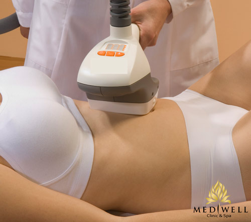 Giảm béo miễn phí, duyên dáng đón hè - 2