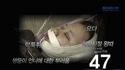 Thiếu nữ Hàn Quốc xinh đẹp hơn nhờ căn chỉnh mặt lệch - 5