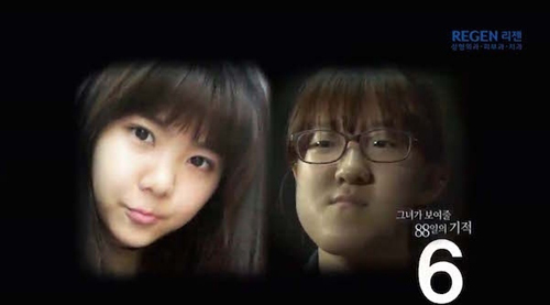 Thiếu nữ Hàn Quốc xinh đẹp hơn nhờ căn chỉnh mặt lệch - 2