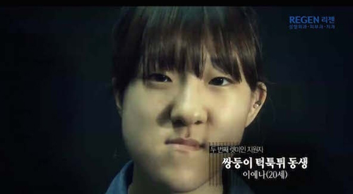 Thiếu nữ Hàn Quốc xinh đẹp hơn nhờ căn chỉnh mặt lệch - 3