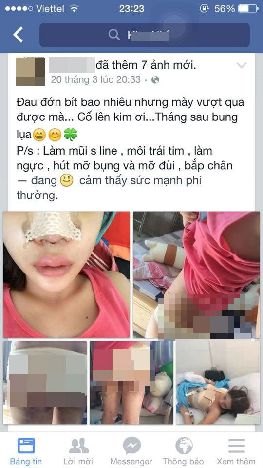 Cô gái Việt đăng ảnh phẫu thuật toàn thân gây sốc - 1