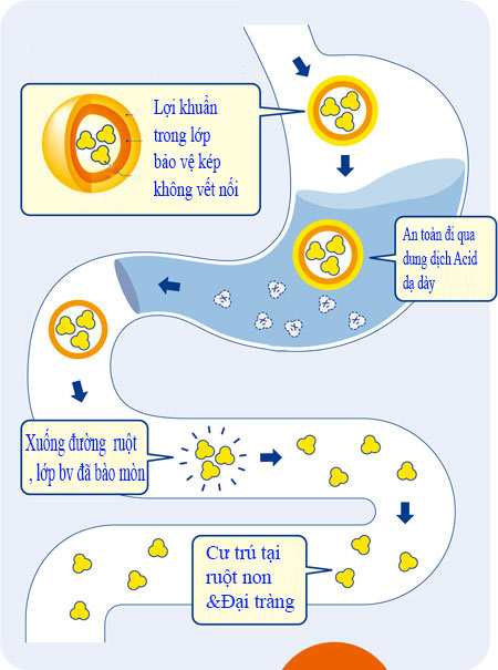 Cách thoát khỏi viêm đại tràng mạn tính - 2