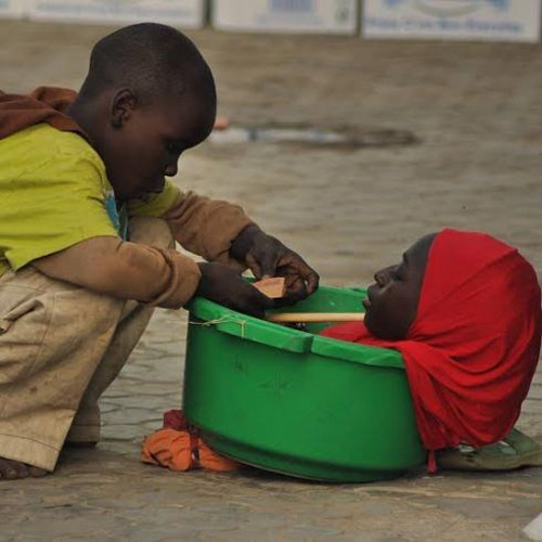 Xót xa hình ảnh cô gái cả đời sống trong... chậu nhựa - 3