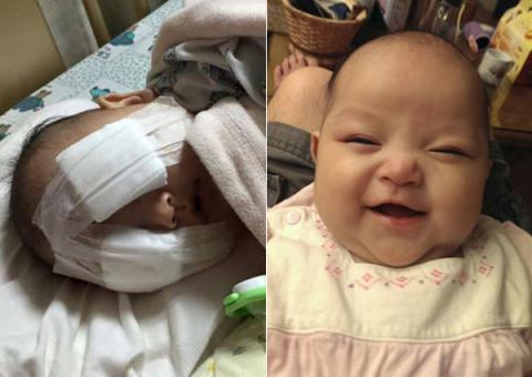 Xót thương bé gái 8 tháng tuổi bị hỏng hai mắt vì ung thư - 1