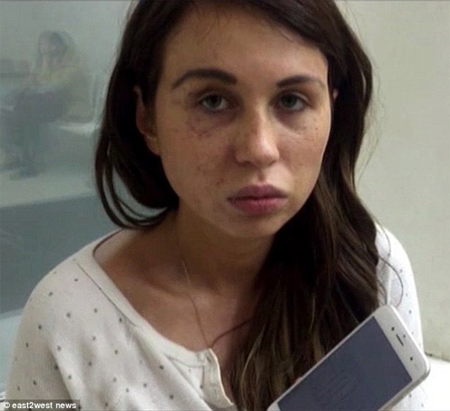 Người mẫu Nga bị bạn trai cũ cưỡng bức và đánh vỡ mũi - 1