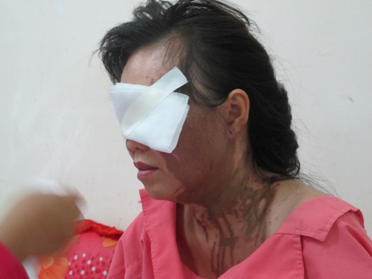 Một phụ nữ bị tạt axit tại trung tâm TP HCM - 1