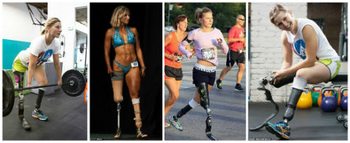 Cô gái không chân và sự kỳ diệu của thể thao - 1