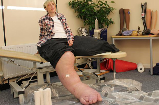 Mandy Sellars sở hữu một đôi chân lớn nhất thế giới, và mỗi năm, chúng lại đánh bại kỷ lục trước đó của mình vì chúng không ngừng phát triển. Vào thời điểm này, chiều dài bàn chân của cô là 40 cm, bắp chân có chu vi là 90 cm 