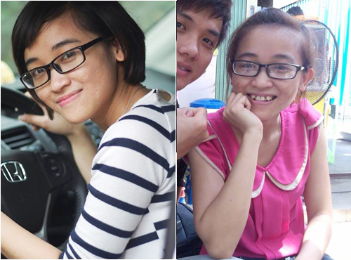 Gặp lại nữ sinh trường Y một năm lột xác nhờ 'dao kéo' - 3