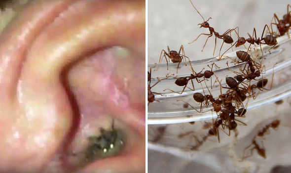 Hoảng sợ với đàn kiến sống thành bầy trong tai bé gái - 1