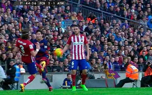 Rợn tóc gáy với đầu gối sưng đỏ vì bị đạp của Messi - 1