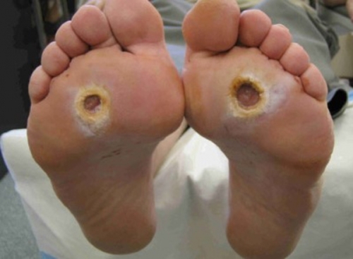 8 bệnh ghê sợ nhất mà con người đang mắc - 2