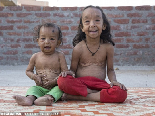 Ấn Độ: Hai chị em ruột cùng bị lão hóa - 1