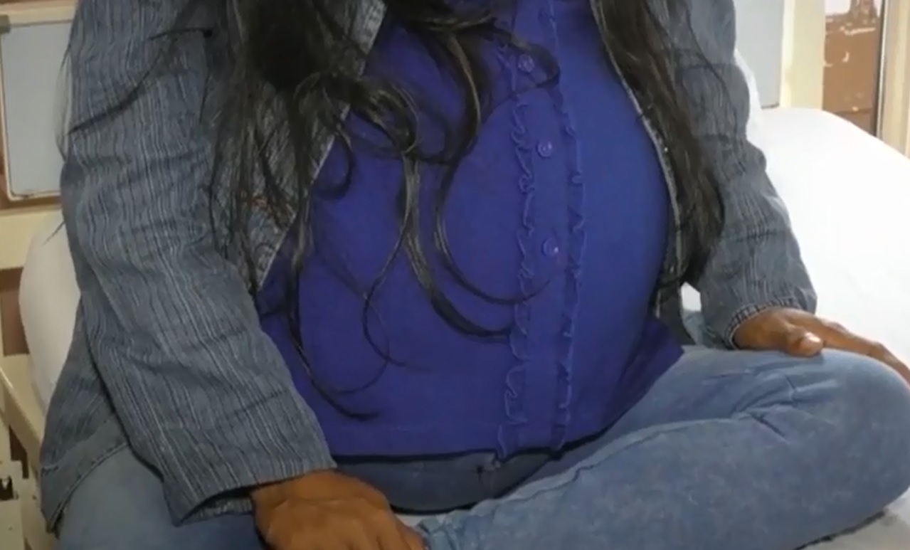 Peru: Người phụ nữ đeo khối u khổng lồ 16 cân suốt 9 năm - 1