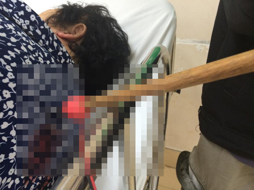 Dùng tên bắn chó đâm bà lão, cướp giỏ xách - 1