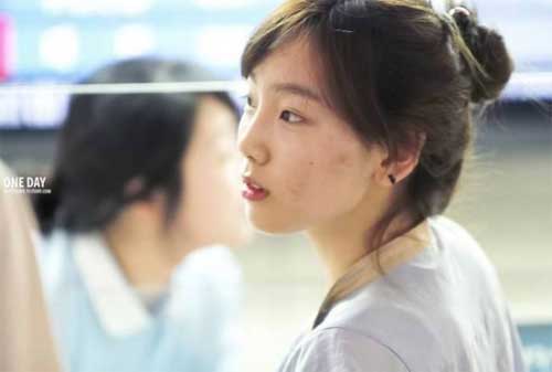 11 mỹ nam, mỹ nữ Hàn có làn da bị "giặc mụn" tàn phá - 7